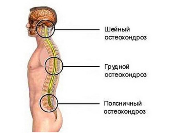 Симптомы сужения сосудов головного мозга: методы лечения