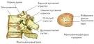 Остеохондроз позвоночника: патогенез, неврологические