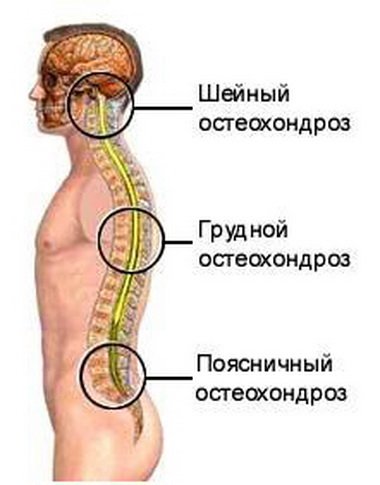 Онемение верхних конечностей (рук) - Клиника Доктора Игнатьева