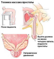 Лечение остеохондроза грудного отдела позвоночника